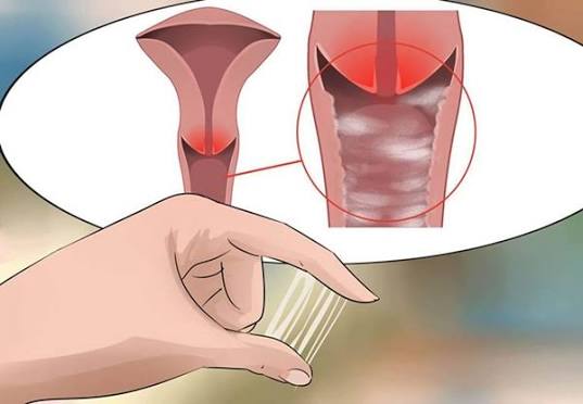Đau khi quan hệ ở nữ: Nguyên nhân và cách điều trị